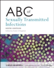 ABC of Sexually Transmitted Infections - Book