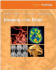 Imaging of the Brain : Expert Radiology Series - Book
