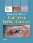 Diagnostic Atlas of Common Eyelid Diseases - eBook