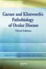 Garner and Klintworth's Pathobiology of Ocular Disease - eBook