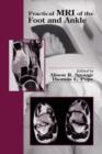Practical MRI of the Foot and Ankle - eBook