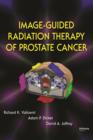 Image-Guided Radiation Therapy of Prostate Cancer - eBook
