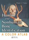 Human and Nonhuman Bone Identification : A Color Atlas - Book