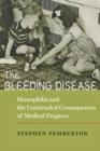 The Bleeding Disease : Hemophilia and the Unintended Consequences of Medical Progress - Book