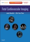 Fetal Cardiovascular Imaging: A Disease Based Approach : Expert Consult Premium - eBook