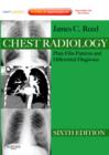Chest Radiology : Plain Film Patterns and Differential Diagnoses, Expert Consult - Online and Print - Book