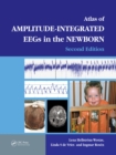 An Atlas of Amplitude-Integrated EEGs in the Newborn - eBook