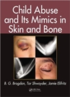Child Abuse and its Mimics in Skin and Bone - Book