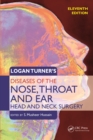 Logan Turner's Diseases of the Nose, Throat and Ear, Head and Neck Surgery - eBook
