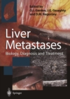 Liver Metastases : Biology, Diagnosis and Treatment - eBook