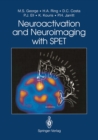 Neuroactivation and Neuroimaging with SPET - eBook