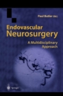 Endovascular Neurosurgery : A Multidisciplinary Approach - eBook