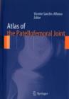 Atlas of the Patellofemoral Joint - Book