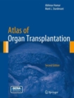 Atlas of Organ Transplantation - Book