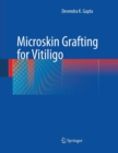 Microskin Grafting for Vitiligo - Book