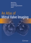 An Atlas of Mitral Valve Imaging - Book