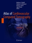 Atlas of Cardiovascular Computed Tomography - Book