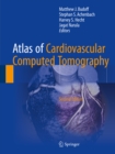 Atlas of Cardiovascular Computed Tomography - eBook