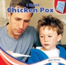 I Have Chicken Pox - eBook