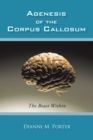 Agenesis of the Corpus Callosum : The Beast Within - eBook