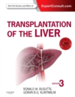 Transplantation of the Liver - Book