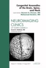 Congenital Anomalies of the Brain, Spine, and Neck, An Issue of Neuroimaging Clinics : Volume 21-3 - Book
