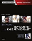 Techniques in Revision Hip and Knee Arthroplasty E-Book : Expert Consult - eBook