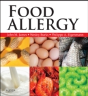 Food Allergy : Expert Consult Basic - eBook