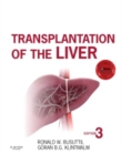 Transplantation of the Liver - eBook