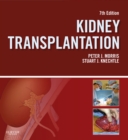 Kidney Transplantation - Principles and Practice E-Book - eBook