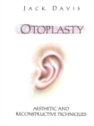 Otoplasty : Aesthetic and Reconstructive Techniques - eBook
