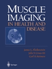Muscle Imaging in Health and Disease - eBook