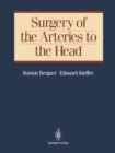 Surgery of the Arteries to the Head - eBook