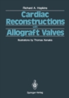 Cardiac Reconstructions with Allograft Valves - eBook