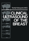 Clinical Ultrasound of the Breast - eBook
