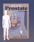 Atlas of the Prostate - Book
