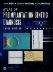 Atlas of Preimplantation Genetic Diagnosis - Book