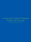 Living with Crohn'S Disease a Story of Survival: Autobiography by Paul Davies - eBook