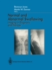 Normal and Abnormal Swallowing : Imaging in Diagnosis and Therapy - eBook