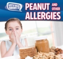 Peanut and Other Food Allergies - eBook