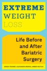 Extreme Weight Loss : Life Before and After Bariatric Surgery - Book