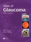 Atlas of Glaucoma - Book