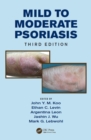 Mild to Moderate Psoriasis - eBook