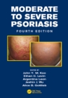 Moderate to Severe Psoriasis - eBook