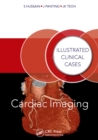 Cardiac Imaging : Illustrated Clinical Cases - eBook
