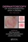 Dermatoscopy of Non-Pigmented Skin Tumors : Pink - Think - Blink - Book