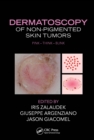 Dermatoscopy of Non-Pigmented Skin Tumors : Pink - Think - Blink - eBook