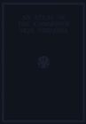 An Atlas of the Commoner Skin Diseases : With 139 Plates Reproduced by Direct Colour Photography from the Living Subject - eBook