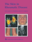 The Skin in Rheumatic Disease - eBook