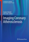 Imaging Coronary Atherosclerosis - eBook